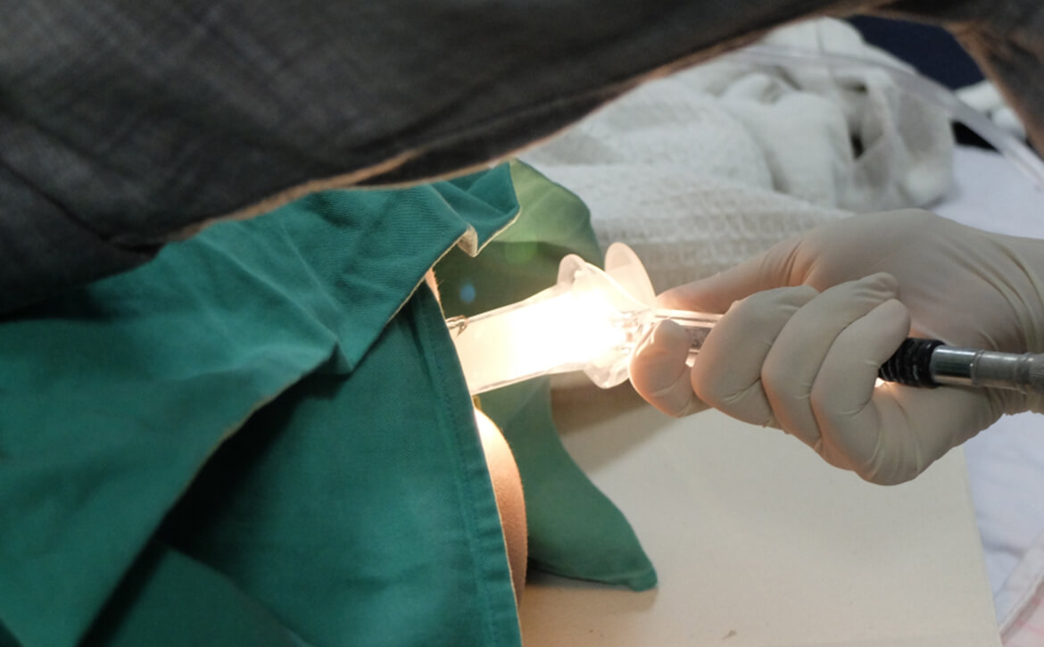daycare surgery